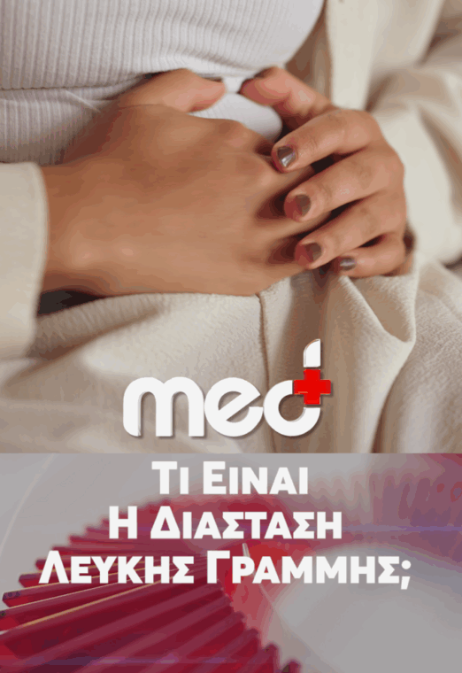 Τι είναι η Διάσταση Λευκής Γραμμής;